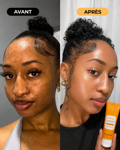 Gel Anti-Boutons & Anti-Taches – Éclat Rapide